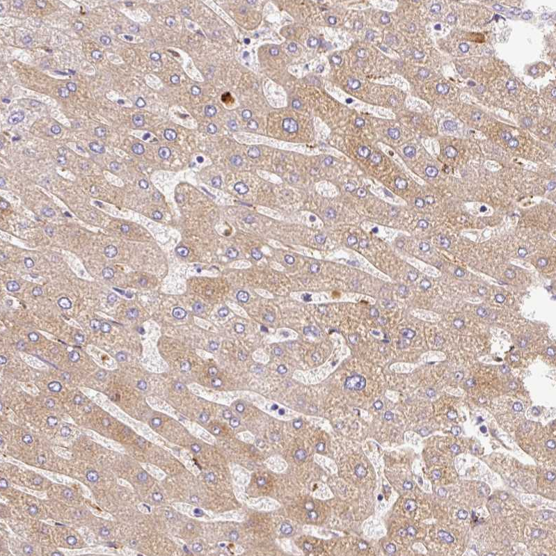 Atlas Antibodies Anti-APCS Antibody