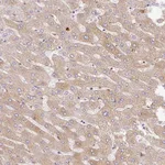 Atlas Antibodies Anti-APCS Antibody