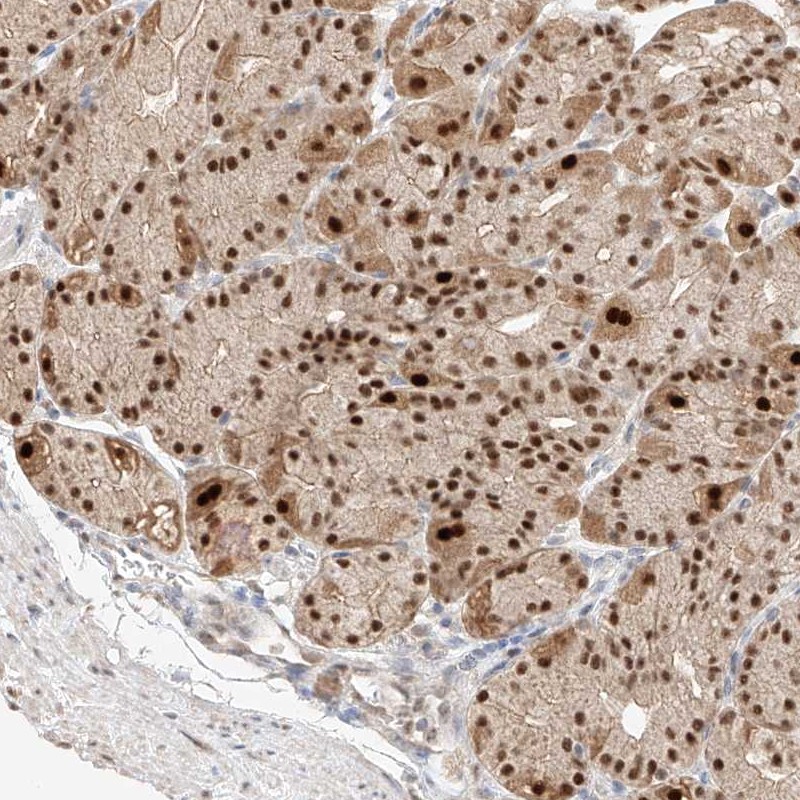 Atlas Antibodies Anti-APIP Antibody