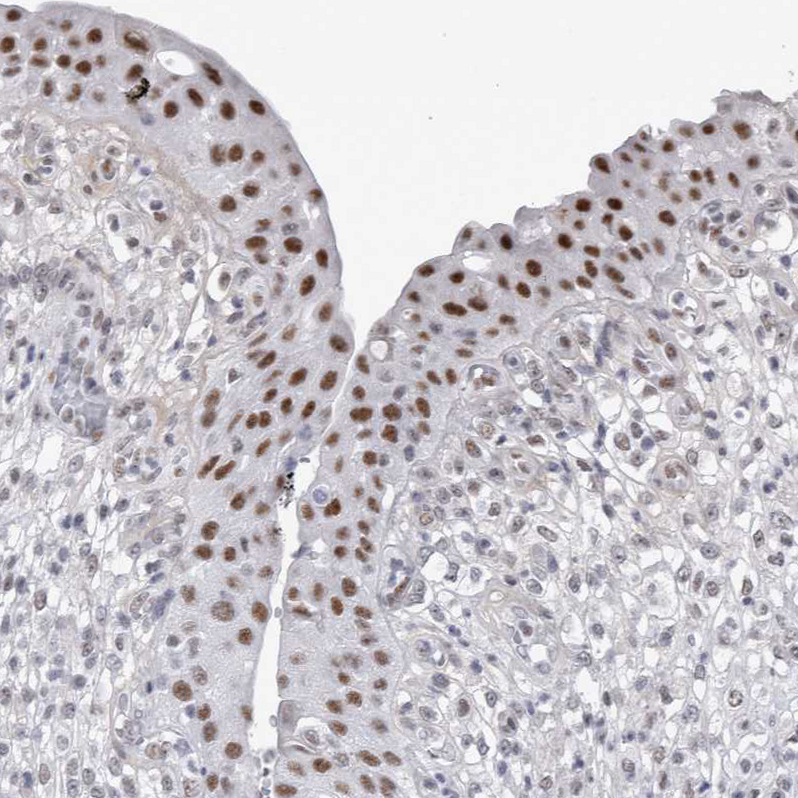 Atlas Antibodies Anti-API5 Antibody