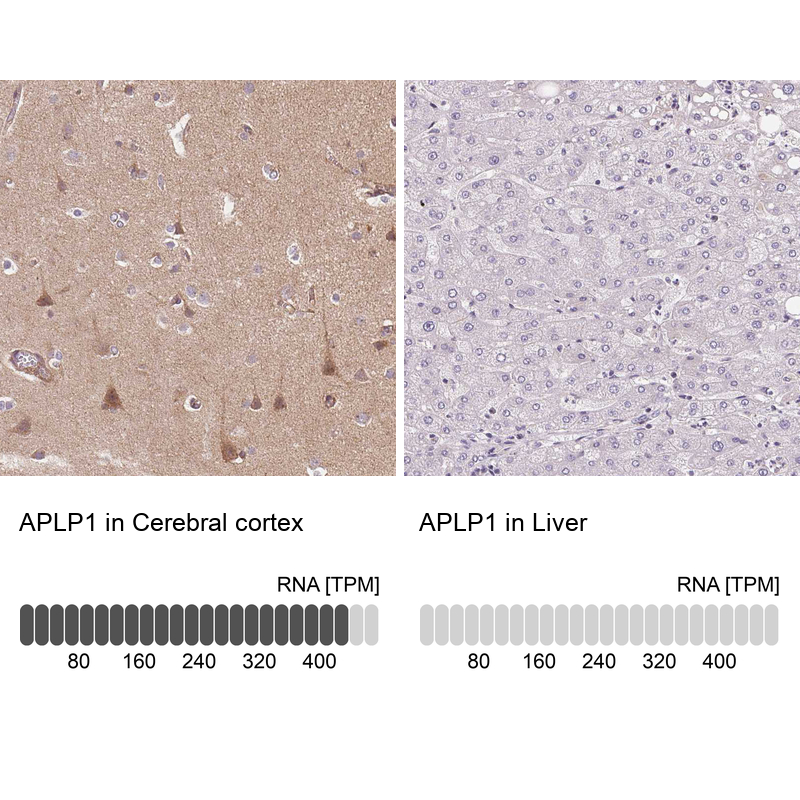 Atlas Antibodies Anti-APLP1 Antibody