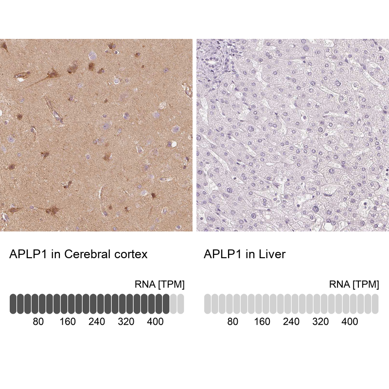 Atlas Antibodies Anti-APLP1 Antibody