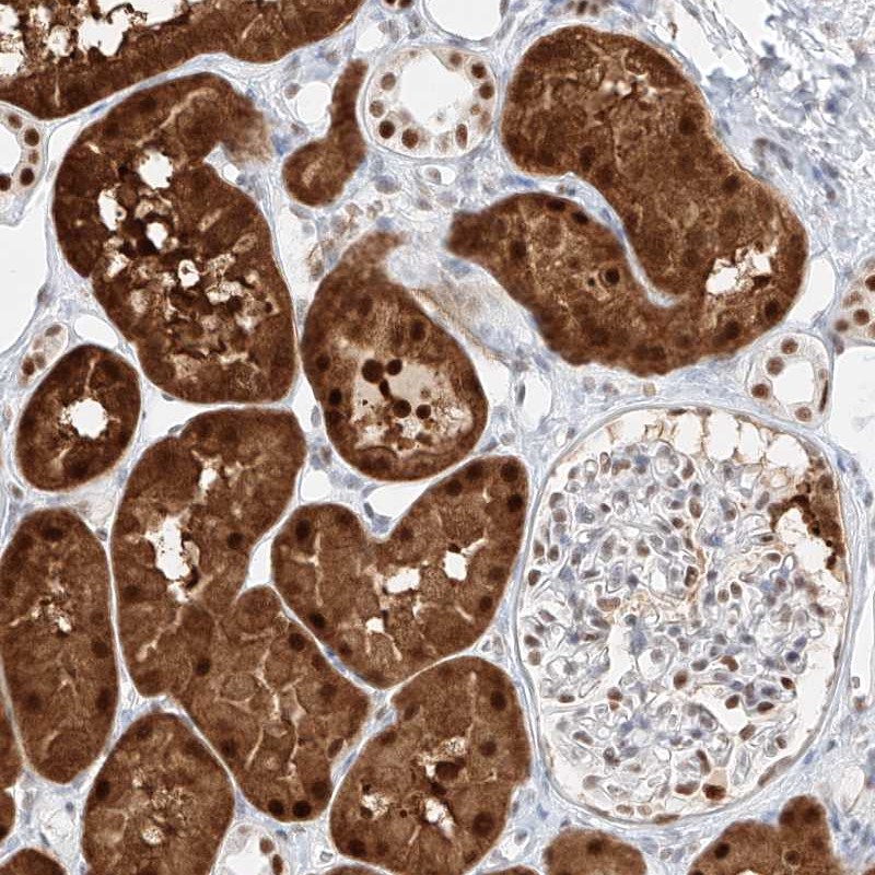 Atlas Antibodies Anti-APIP Antibody