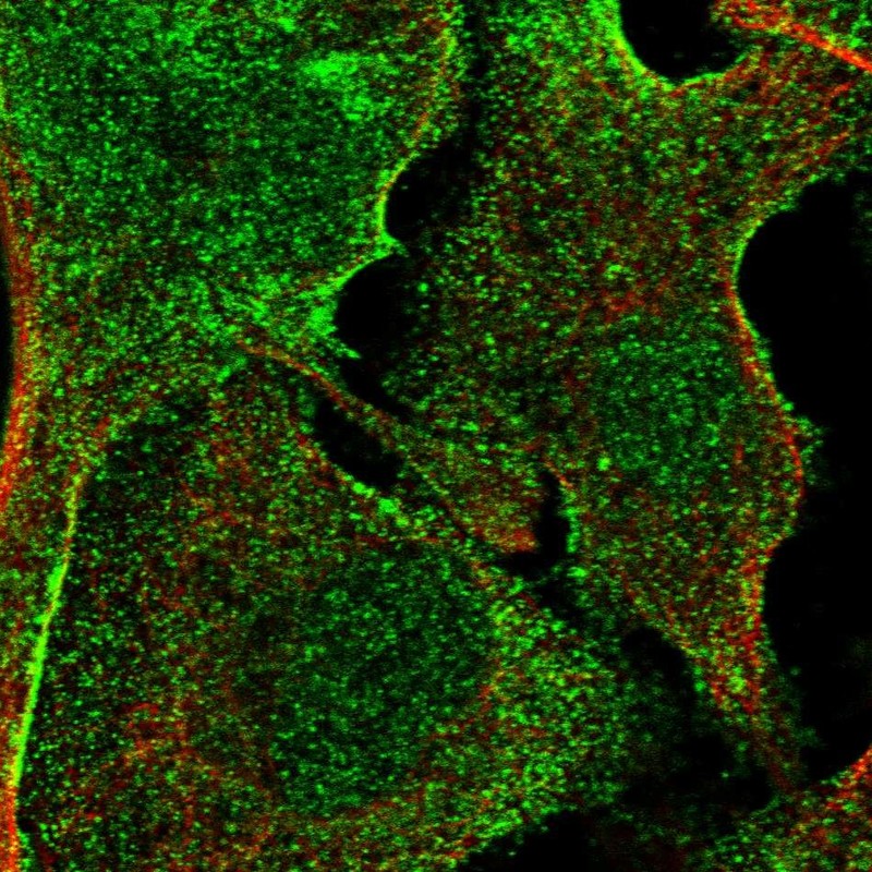 Atlas Antibodies Anti-APMAP Antibody