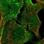 Atlas Antibodies Anti-APMAP Antibody