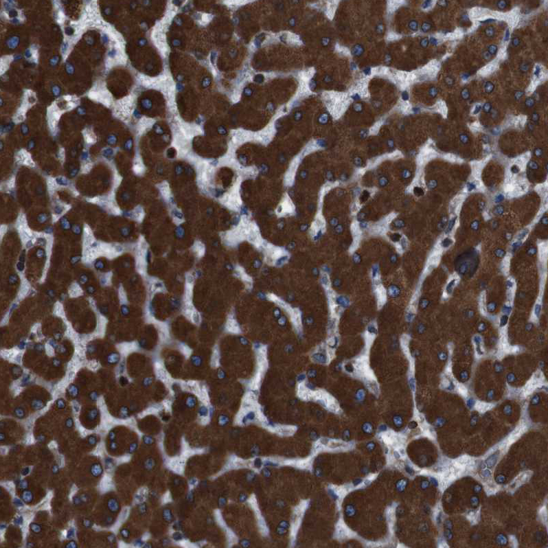 Atlas Antibodies Anti-APMAP Antibody