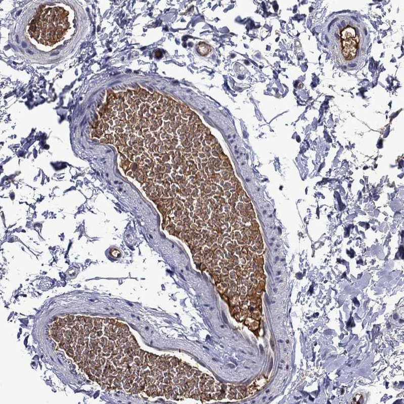 Atlas Antibodies Anti-APOA2 Antibody