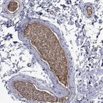 Atlas Antibodies Anti-APOA2 Antibody