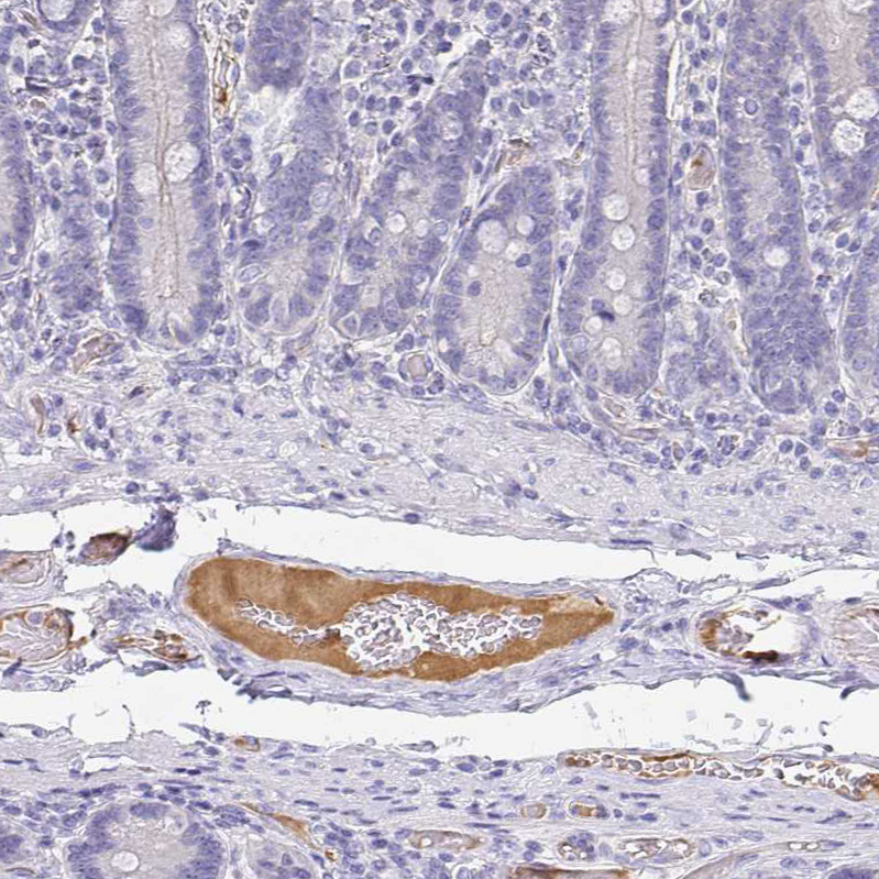 Atlas Antibodies Anti-APOB Antibody