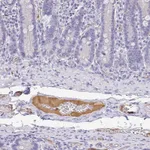 Atlas Antibodies Anti-APOB Antibody