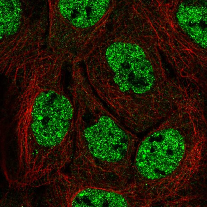 Atlas Antibodies Anti-APOBEC3B Antibody