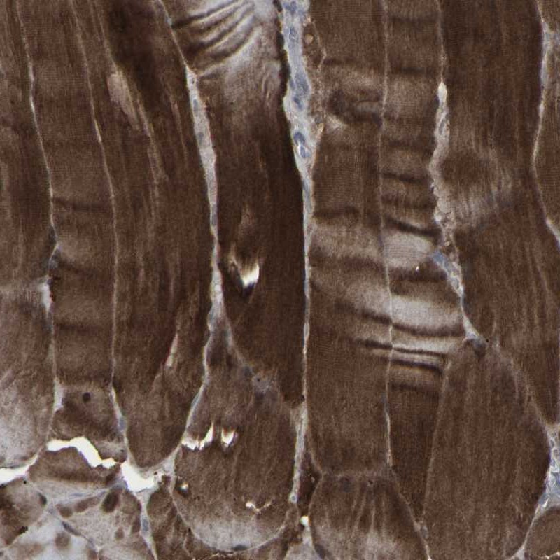 Atlas Antibodies Anti-APOBEC2 Antibody