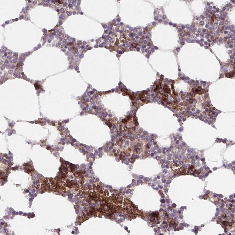 Atlas Antibodies Anti-APOBEC3D Antibody