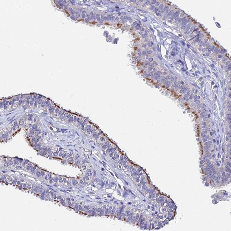 Atlas Antibodies Anti-APOBEC3H Antibody
