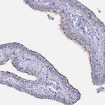 Atlas Antibodies Anti-APOBEC3H Antibody