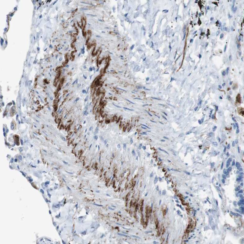 Atlas Antibodies Anti-APOBEC4 Antibody