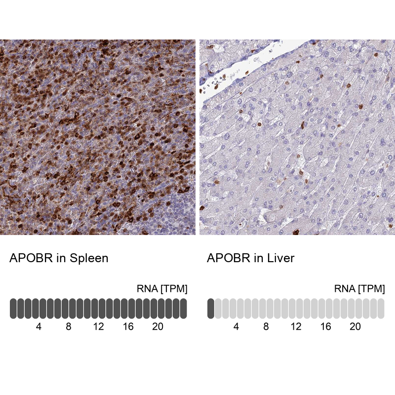 Atlas Antibodies Anti-APOBR Antibody