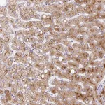 Atlas Antibodies Anti-APOC2 Antibody