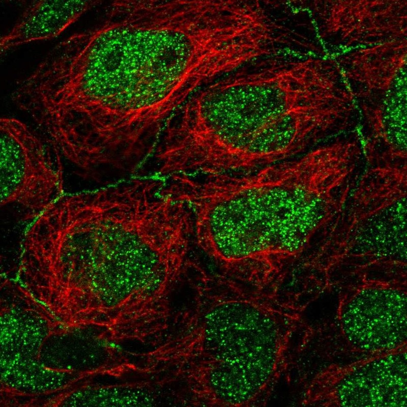 Atlas Antibodies Anti-APOC3 Antibody