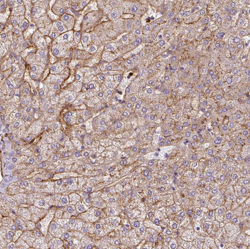 Atlas Antibodies Anti-APOC1 Antibody