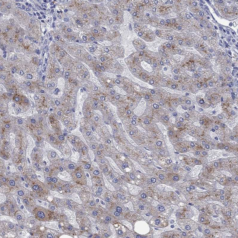Atlas Antibodies Anti-APOC3 Antibody