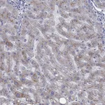 Atlas Antibodies Anti-APOC3 Antibody