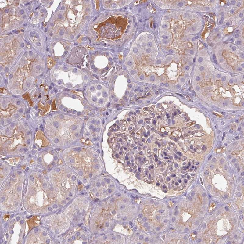Atlas Antibodies Anti-APOC4 Antibody