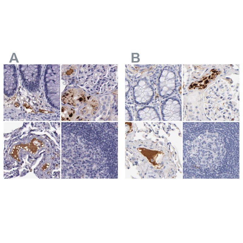 Atlas Antibodies Anti-APOH Antibody