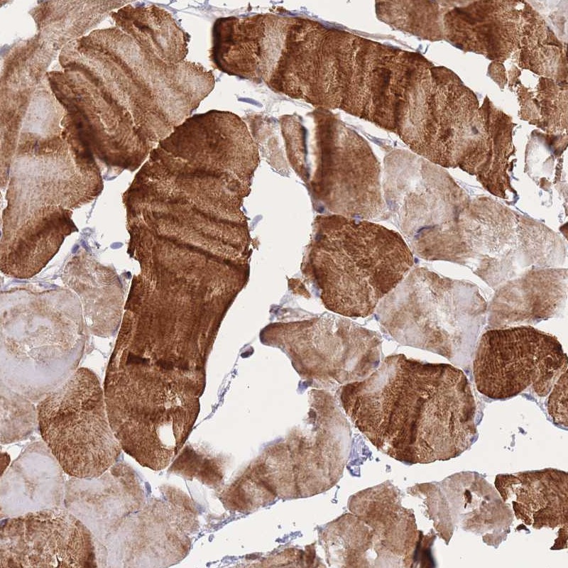 Atlas Antibodies Anti-APOL4 Antibody