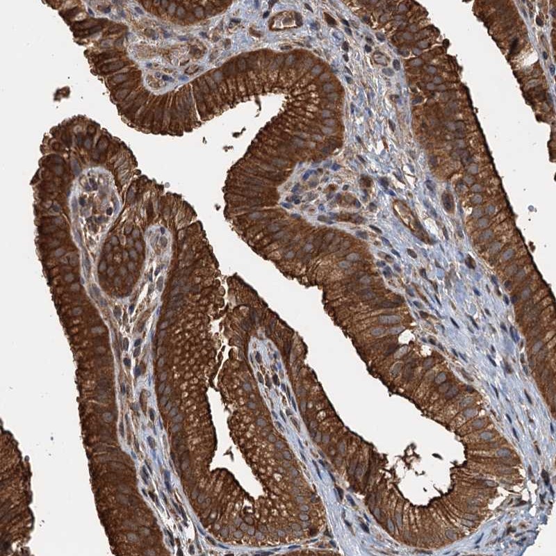 Atlas Antibodies Anti-APOL5 Antibody
