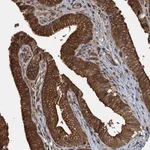 Atlas Antibodies Anti-APOL5 Antibody
