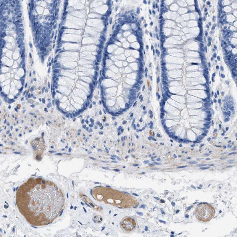 Atlas Antibodies Anti-APOL1 Antibody