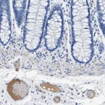 Atlas Antibodies Anti-APOL1 Antibody