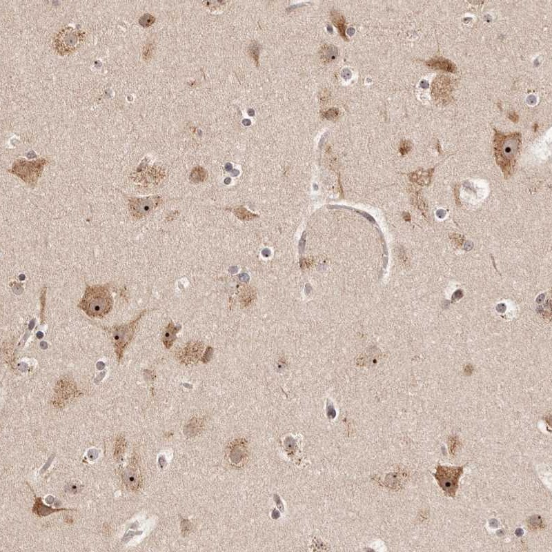 Atlas Antibodies Anti-APOL6 Antibody