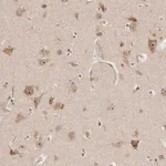 Atlas Antibodies Anti-APOL6 Antibody