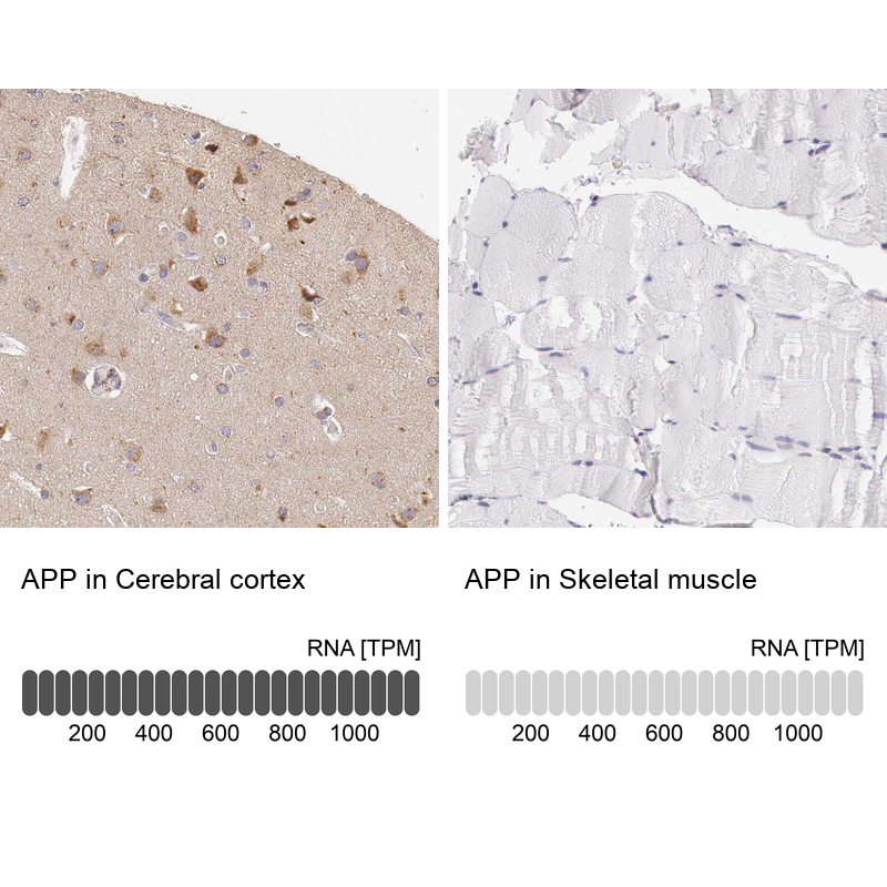 Atlas Antibodies Anti-APP Antibody