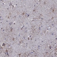 Atlas Antibodies Anti-APPBP2 Antibody