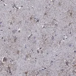Atlas Antibodies Anti-APPBP2 Antibody