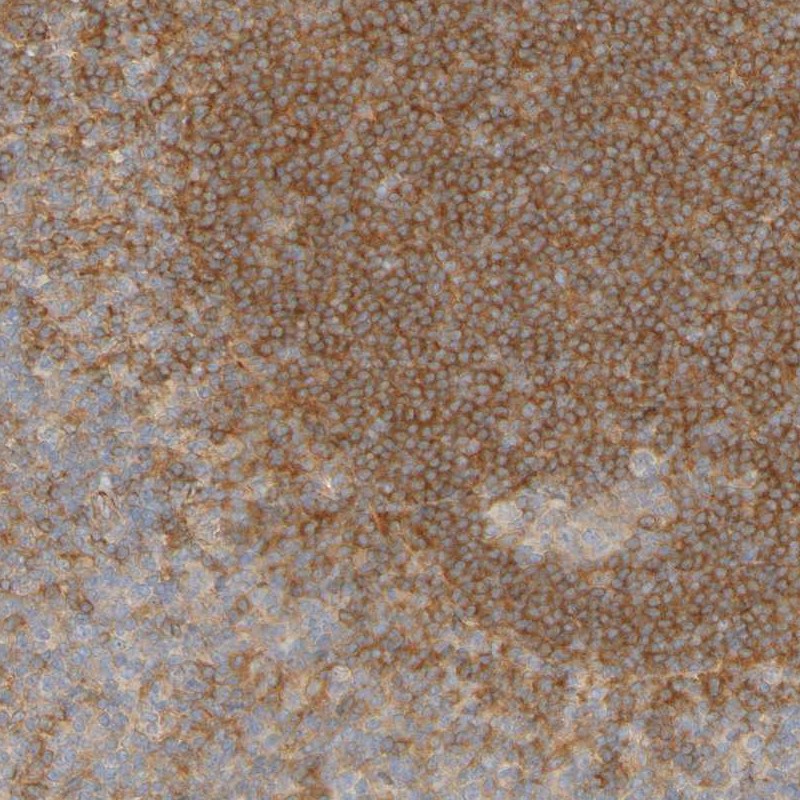 Atlas Antibodies Anti-APPL1 Antibody