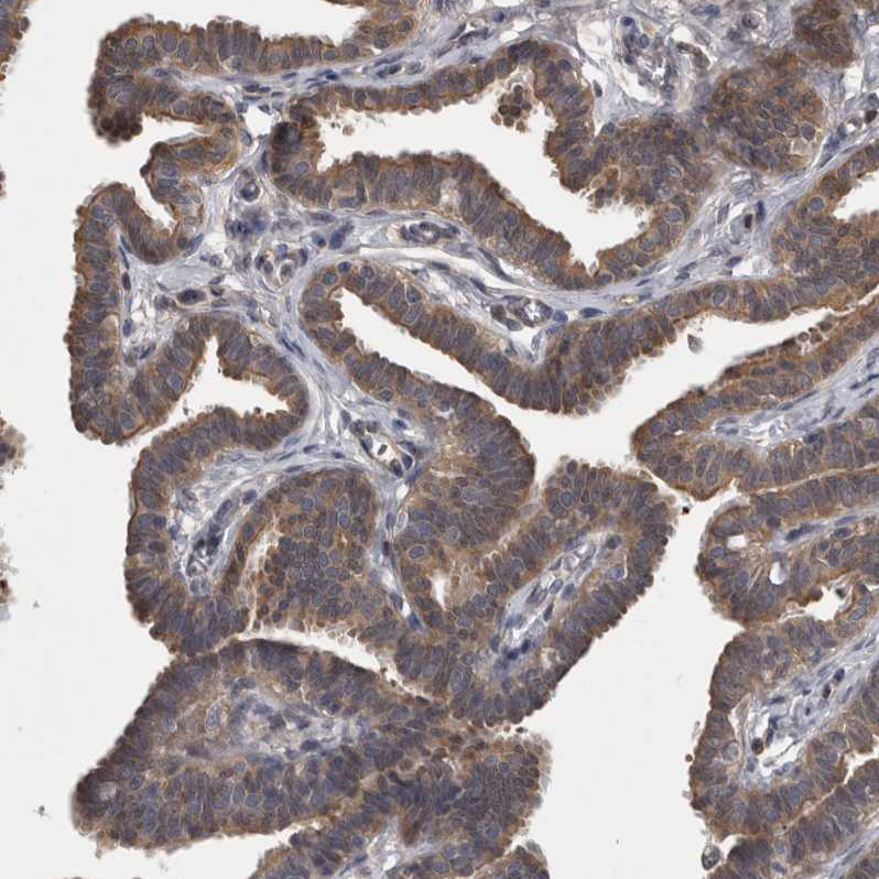 Atlas Antibodies Anti-APRT Antibody