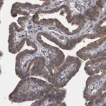 Atlas Antibodies Anti-APRT Antibody