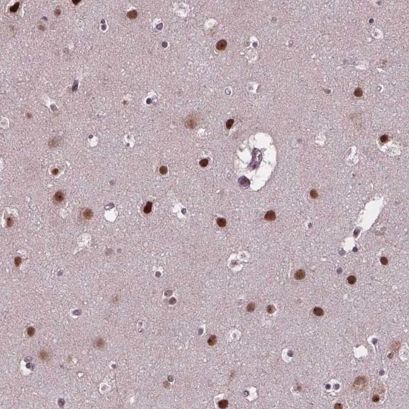 Atlas Antibodies Anti-APTX Antibody