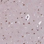 Atlas Antibodies Anti-APTX Antibody