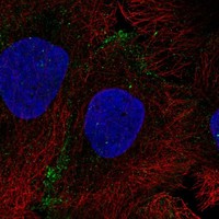 Atlas Antibodies Anti-AQP10 Antibody
