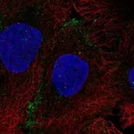 Atlas Antibodies Anti-AQP10 Antibody