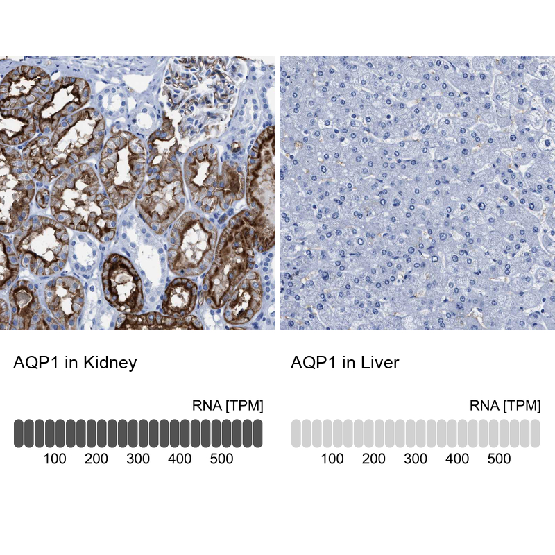 Atlas Antibodies Anti-AQP1 Antibody