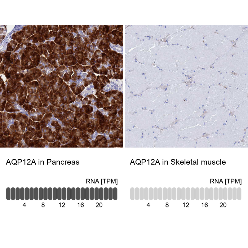 Atlas Antibodies Anti-AQP12A Antibody