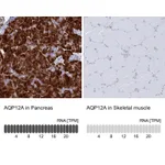 Atlas Antibodies Anti-AQP12A Antibody