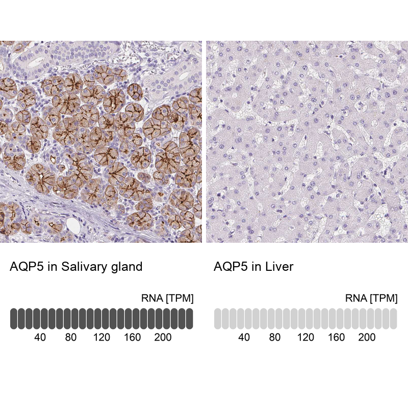 Atlas Antibodies Anti-AQP5 Antibody