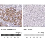 Atlas Antibodies Anti-AQP5 Antibody